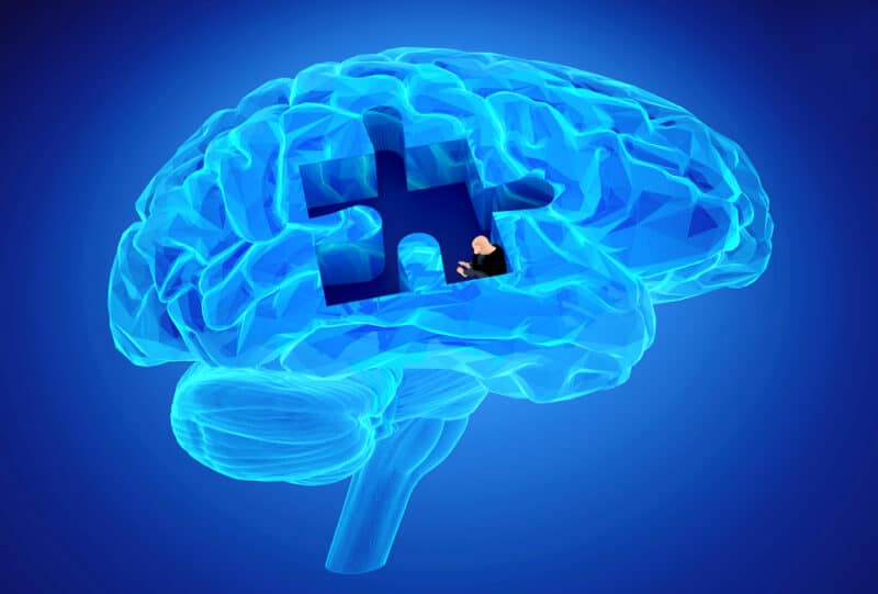 AI Model Detects Early Signs of Parkinson’s