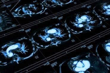 Deep Learning Poised to Transform Medical Imaging