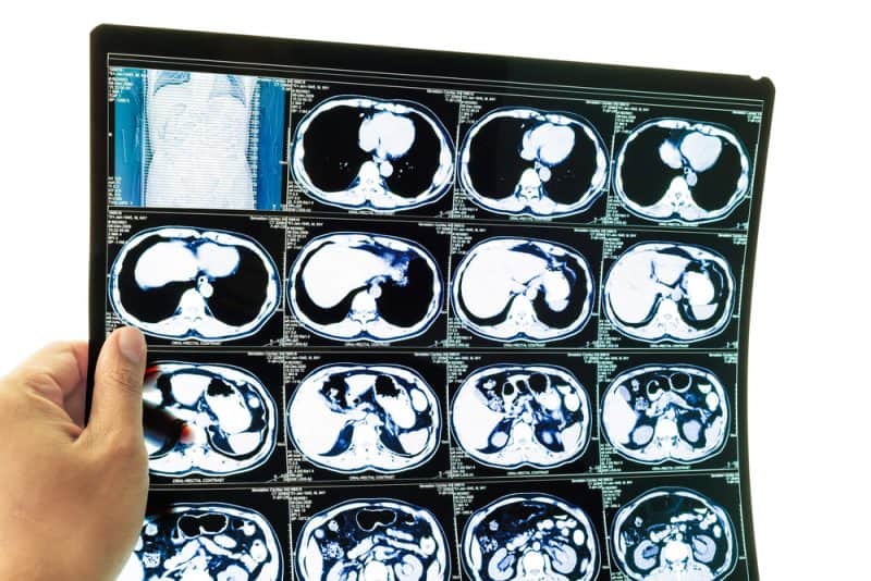 UK Researchers Develop AI To Detect Brain Injuries